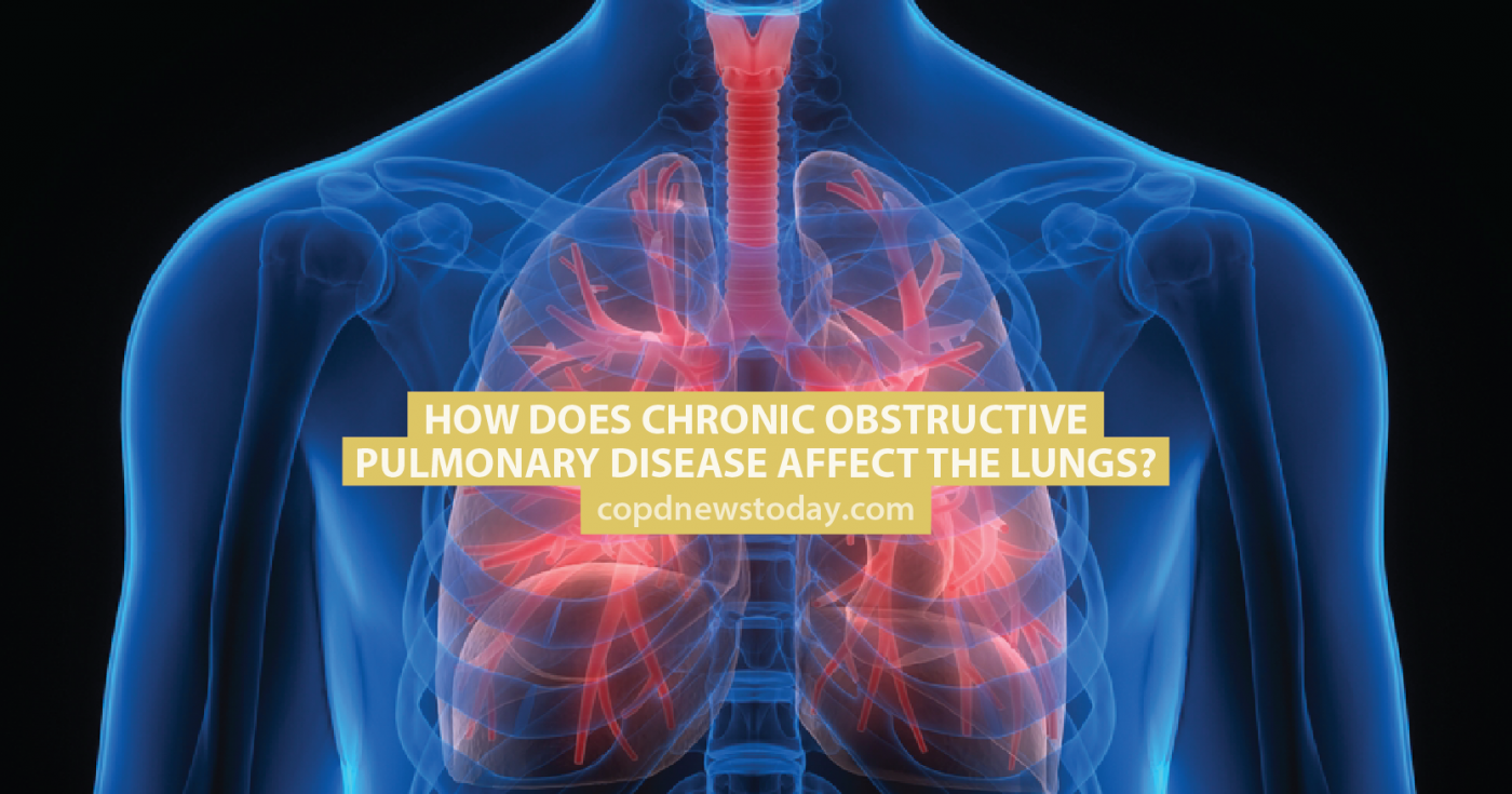 How Does Chronic Obstructive Pulmonary Disease Affect the How Does Chronic Obstructive Pulmonary Disease Affect the